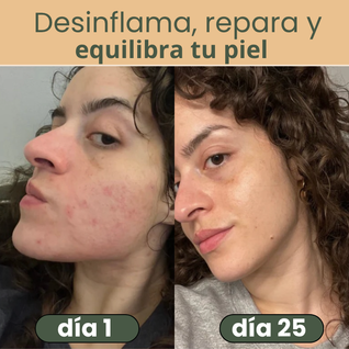NALUA Serum 2 en 1 Anti Acné y Anti Manchas